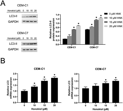 Figure 5. Effect of honokiol at different concentrations on cell autophagy of T-ALL cell lines. The expression level of the autophagy-related protein LC3-II (A) and LC3 mRNA (B) in DEX-resistant CEM-C1 cells and DEX – sensitive CEM-C7 cells upon the treatment of honokiol at different concentrations (0–20 µM) were determined using western blot and RT-qPCR, respectively. Data represent mean ± SD (n = 3), *p < 0.05 as compared to the control group.