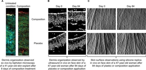 Figure 4 Modulation of dermis structure of skins treated with the composition studied either (A) ex vivo (41-year-old skin explants, bi-photon microscopy) or (B and C) in vivo (47-year-old women).Notes: (B) Skin structures observed by ultrasound; (C) skin surfaces analyzed by silicone replica.