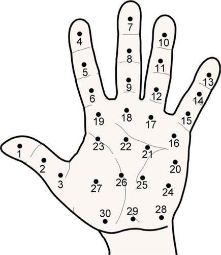 Figure 5 Points of assessment for topographical pressure pain sensitivity maps of the hand.