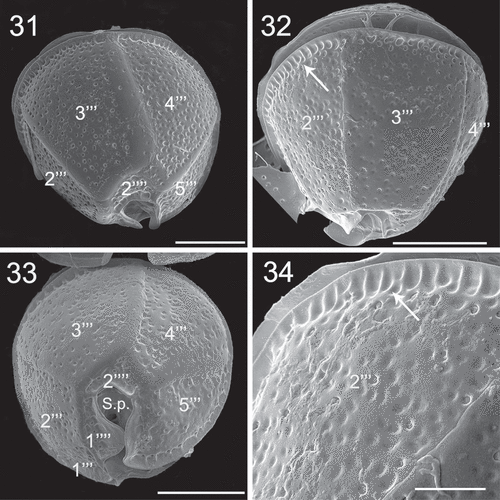 Figs 31–34. SEM micrographs of Coolia cf. canariensis phylogroup II. Figs 31–32. Oblique-dorsal view. Fig. 33. Antapical view. Fig. 34. Detail of the surface of plate 2′′′. Arrows: extensions of the thecal surface towards the cingulum. Scale bars: (31–33): 10 µm; (34): 4 µm.