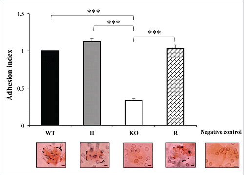 Figure 4. The adhesion ability of C. parapsilosis wild type (WT), heterozygous (H), null (KO) and reconstituted (R) mutant strains was tested on human buccal epithelial cells obtained from a healthy donor not colonized with Candida spp. Bars represent adhesion index mean ± standard error of mean. At least 3 biological replicates were used. ***P < 0.001. Micrographs below bars show representative Gram-stained C. parapsilosis blastoconidia from each of the strains adhered to a buccal cell observed at a magnification of 1000 ×. Scale bar denotes 10 μm.