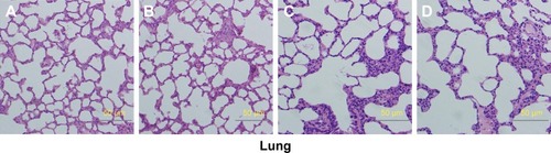 Figure 7 Histologic sections of thyroid, liver, and lung.Notes: (A) Male rats of nano-Cu/LDPE group. (B) Male rats of control group. (C) Female rats of nano-Cu/LDPE group. (D) Female rats of control group. No abnormalities were detected in any groups.Abbreviation: Cu/LDPE, copper/low-density polyethylene nanocomposite.