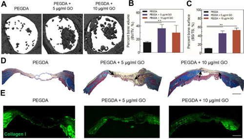 Figure 6  (A) Micro-CT image of new bone formation in mouse calvaria defect model (defect dia. = 4 mm). (B) Percent bone volume and (C) percent bone surface of PEGDA + 5 μg/mL GO and PEGDA + 10 μg/mL GO group was significantly higher than hTMSCs on PEGDA group (n = 3, p < 0.01). (D) Masson’s trichrome staining for histological analysis of regenerated bone tissue (scale bar = 500 µm). (Black arrow indicated the newly deposited collagen) (E) Immunostaining was done for collagen type I in regenerated bone for each groups (scale bar = 500 µm). Reprinted with permission from Kim HD, Kim J, Koh RH, et al. Enhanced Osteogenic commitment of human Mesenchymal stem cells on polyethylene glycol based Cryogel with Graphene oxide substrate. ACS Biomater Sci Eng. 2017;3(10):2470-2479. Copyright 2017 American Chemical Society.Citation64