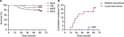 Figure 3 Results of follow-up evaluations.Notes: Panel A: OS, DFS, RFS and distant MFS of the 45 LARC patients treated with NACRT and TME. Panel B: Distant metastasis and local recurrence rates of the 45 LARC patients treated with NACRT and TME.Abbreviations: DFS, disease-free survival; LARC, locally advanced rectal cancer; MFS, metastasis-free survival; NACRT, neoadjuvant chemoradiotherapy; OS, overall survival; RFS, local recurrence-free survival; TME, total mesorectal excision.