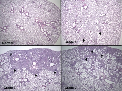 Figure 1 Representative lung photomicrographs. Typical images that were used for semiquantitative assessment of lung pathology are shown (4 × magnification). Upper left: normal, mouse/slide 81, MouseTrack #193319; Upper right: grade 1, Mouse/slide 34, MouseTrack #184942; Lower right: grade 2, mouse/slide 74, MouseTrack #192908; Lower left: grade 3, mouseslide 73, MouseTrack #192907.