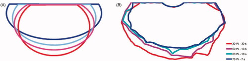 Figure 3. Thermal lesion contours from the ex vivo experiments performed by Bouriel et al. [Citation7] (A) and from simulations computed by the Arrhenius contour Ω = 1 after a 1-min cooling period (B) with one standard setting (30 W/30 s) and three HPSD settings (50 W/13 s, 60 W/10 s, 70 W/7 s).