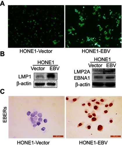 Figure 1 The EBV genes expression were frequently detected in HONE1-EBV cells. (A). Green fluorescent protein (GFP) was observed under fluorescence microscope in HONE1-Vector and HONE1-EBV cells. (B). The expression level of LMP1, LMP2A, EBNA1 proteins were measured by western-blot in HONE1-Vector and HONE1-EBV cells. (C). The expression level of EBERs protein were measured by in situ hybridization in HONE1-Vector and HONE1-EBV cells. Experiments were repeated 3 times, and error bars represent ± SD.Abbreviations: LMP1, latent membrane protein 1; LMP2A, latent membrane protein 2A; EBNA1, Epstein–Barr virus nuclear antigen 1; EBERs, Epstein–Barr virus-encoded small RNAs.