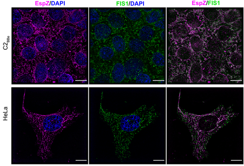 Figure 2. EPEC EspZ colocalizes with mitochondrial fission protein FIS1. C2BBe and HeLa transfected with espZ-encoding plasmid (pEspZHA) were fixed and stained for FIS1 (green) and EspZ (magenta). DNA was stained with 4,6- diamidino-2-phenylindole (DAPI; blue). Scale bar: 15 μm (C2BBe; top panels) and 10 μm (HeLa; bottom panels). Images shown are representative of >6 images captured from three independent experiments. Overlapping staining of FIS1 and EspZ was confirmed by positive Pearson correlation coefficients of 0.486 ± (C2BBe) and 0.795 (HeLa).