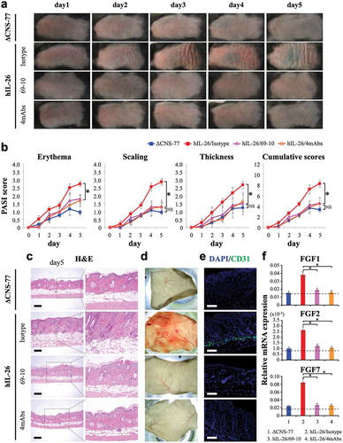 Figure 7. Anti-IL-26 mAb treatment suppresses IMQ-induced skin inflammation via inhibition of angiogenesis and infiltration of inflammatory cells.Data are shown from IMQ (20 mg)-treated back skin in ΔCNS-77 Tg mice, hIL-26Tg mice treated with anti-IL-26 mAb (69–10 mAb alone or the combination of 4 mAbs) or isotype control mAb. (a) Phenotypical representation of each group. Representative images are shown (n = 6 mice for each group at each time point). (b) Time course of PASI scores (erythema, scaling and thickness were scored daily on a scale from 0 to 4, respectively) in each group (n = 6 mice for each group at each time point). Data are shown as mean ± S.D. of each group, comparing values in hIL-26Tg mice treated with anti-IL-26 mAb to those in hIL-26Tg mice injected with isotype control mAb or those in ΔCNS-77 Tg mice (* p < 0.01). NS denotes ‘not significant’. Data represent the combined results of two independent experiments. (c) H&E staining of skin lesions from each group on day-5. Higher magnification images show inflammatory cell infiltration. Original magnification x100. Scale bar, 200 μm. (d) Subcutaneous vascular formation of each group on day-5. (e) Immunofluorescence staining of skin lesions from each group on day-5 using anti-CD31 pAb. Positive cells were shown in green. All sections were stained with DAPI to mark the nuclei (blue). Original magnification x100. Scale bar, 200 μm. (c-e) Representative images are shown with similar results (for each, n = 6 mice). (f) mRNA expression levels of FGF1, FGF2 and FGF7 in skin lesions from each group on day-3 (n = 6 mice for each group). Each expression was normalized to hypoxanthine phosphoribosyltransferase (HPRT). The dashed line is the mean value of non-treated mice. Data are shown as mean ± S.D. of each group, comparing values in hIL-26Tg mice treated with anti-IL-26 mAb to those in hIL-26Tg mice injected with isotype control mAb (* p < 0.01).