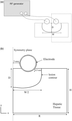 Figure 2. (a) Physical situation considered in the study. The dashed rectangle indicates the region considered in the theoretical model. (b) Theoretical model proposed (out of scale). R and H: dimensions of the hepatic tissue. The inner and outer electrode diameters are 4.5 and 5 mm, respectively. Since there is a symmetrical plane, the model only includes half of the electrode–tissue set. Lesion depth (D) and width (W) were assessed by an Arrhenius damage model (see text for more details).