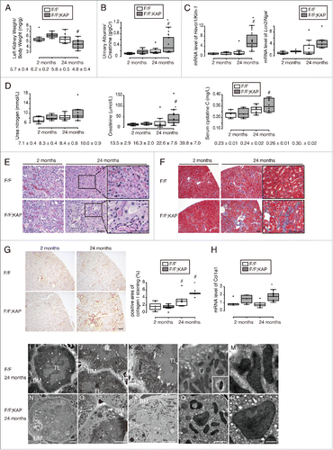 Figure 3. Long-term autophagy deficiency accelerates kidney dysfunction and atrophy. (Ato D) Age-dependent changes in the kidney-to-body weight ratio (A), urinary ALB/albumin levels (B), mRNA levels of Havcr1/Kim-1 and Lcn2/Ngal in kidney cortical regions (C) and kidney function (D) in young and aged Atg5F/Fand atg5F/F-KAP mice are shown (n = 7 to 10 in each group). Data were normalized with 18s-rRNA and presented as the ratio relative to young control kidney. (Eto G) Representative images of PAS-staining (E), Masson trichrome staining (F), and immunostaining for collagen type I (G) in kidney cortical regions of young and aged Atg5F/F and atg5F/F-KAP mice (n = 7 to 10 in each group). Bars: 50 μm (E) and 100 μm (F and G). Magnified images from 24-mo-old mice are presented in the insets. (H) The Col1a1 mRNA levels in kidney cortical regions of young and aged Atg5F/F and atg5F/F-KAP mice (n = 7 to 10 in each group). Data were normalized with 18s-rRNA and presented as the ratio relative to young control kidney. (Ito R) Electron micrographs of aged Atg5F/F (Ito M) and atg5F/F-KAP mice (Nto R) (n = 3 in each group). BM, basement membrane; TL, tubular lumen; *, nucleus. Bars: 10 μm (I, J, N, and Q), 5 μm (Kand P), 2 μm (Land Q) and 500 nm (Mand R). Representative magnified image of mitophagy is presented in the inset (L). Data are provided as mean ± SE. Statistically significant differences (*, P < 0.05 vs. age-matched Atg5F/F control littermates; #, P < 0.05 vs. young mice) are indicated. F/F, Atg5F/F mice; F/F;KAP, atg5F/F-KAP mice.
