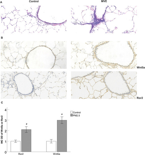 Figure 1 MVE-induced inflammatory changes and the upregulation of Wnt5a and Ror2 in the lungs of rats.