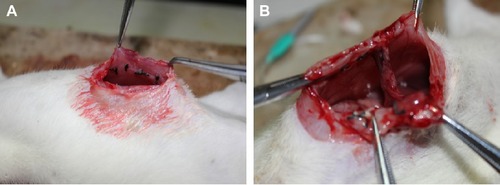 Figure 2 Illustration of experimental postoperative peritoneal adhesions in rats.Notes: (A) Creation of ischemic buttons to peritoneal sidewall. (B) Adhesions to the buttons at postoperative day 7.