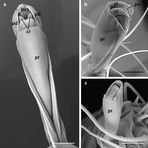 Figure 3. Dermanyssus gallinae: ambulacra; (a) female: dorsal view of the ambulacrum of the third leg with the pulvillus and claws partly retracted in the praetarsus and surrounded by the paradactyli; (b) nymph: lateral view of the ambulacrum of the first leg with the pulvillus fully retracted while the claws are still visible (and would thus contact the substratum); (c) larva: ventral view of the ambulacrum of the first leg with the pulvillus and claws fully retracted in the praetarsus (ambulacrum stalk). Note the absence of the paradactyli in the first leg. Abbreviations: cl: claw; pd: paradactylus; pr: praetarsus; pv: pulvillus. Scale bars: 10 µm.