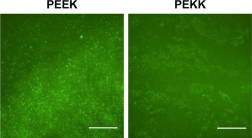 Figure 7 Live/dead assay of Pseudomonas aeruginosa attached on PEEK and PEKK samples (SYTO® 9 and propidium iodide respectively stained live [green] and dead [red] bacteria cells).Notes: No red stained bacteria observed in these images. Scale bars =50 microns.Abbreviations: PEEK, poly-ether-ether-ketone; PEKK, poly-ether-ketone-ketone.