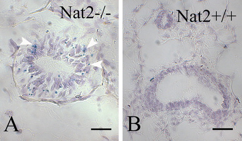 Figure 6.  Nat2 expression in mouse mammary gland epithelia. (A and B) Sections through bluo-gal stained mammary gland isolated from Nat2−/ −  (A) and Nat2+/ +  (control) (B) adult virgin female mice. Blue stain (bluo-gal β-galactosidase substrate) indicates Nat2 expression, detectable in Nat2−/ −  tissues, highlighted with arrow heads. Scale bars: (A, B) 20 µm. Colour available online.