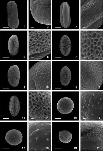 Plate 2. Scanning electron microscopy photographs of pollen grains of Madeira endemic species. 1,2. Melanoselinum decipiens: 1. equatorial view; 2. exine ornamentation. 3,4. Monizia edulis: 3. equatorial view, 4. exine ornamentation; 5,6. Sinapidendron angustifolium. 5. equatorial view, 6. exine ornamentation. 7,8. Sinapidendron frutescens. 7. equatorial view, 8. exine ornamentation. 9,10. Sinapidendron gymnocalyx. 9. equatorial view, 10. exine ornamentation. 11,12. Sinapidendron rupestre. 11. equatorial view, 12. exine ornamentation. 13,14. Sinapidendron sempervivifolium. 13. equatorial view, 14. exine ornamentation. 15,16. Musschia aurea. 15. equatorial view, 16. exine ornamentation. 17,18. Musschia wollastonii. 17. equatorial view, 18. exine ornamentation. 19,20. Chamaemeles coriacea. 19. equatorial view, 20. exine ornamentation. Scale bars: 10 µm (1, 3, 5, 7, 9, 11, 13, 15, 17, 19), 1 µm (2, 4, 6, 8, 10, 12, 14, 16, 18, 20).