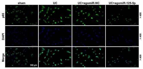 Figure 9. Fluorescence microscopy (BX61, Olympus, Japan) was used to observe the transfer of p65 in mouse intestinal epithelial cell nucleus. We found that within 1 h of staining, p65 translocation was found in the UC group and the UC+ agomiR-NC group