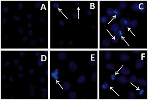 Figure 5. Morphological and nuclear changes of HepG2 (A-C) and A549 (D-F) cells treated with P-DOX and P-DOX-Oct for 24 h as determined by DAPI staining. A and D: control groups. B and E: P-DOX treated groups. C and F: P-DOX-Oct treated groups. The white arrows pointed to the apoptosis and necrosis.