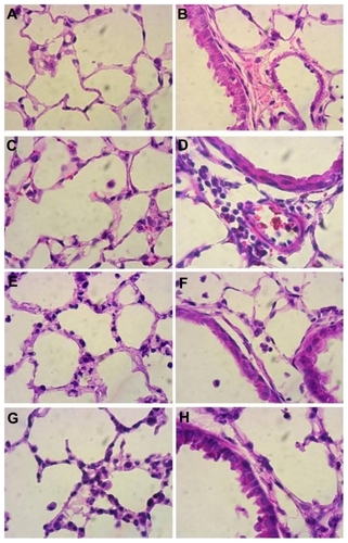 Figure 2 Histopathology of lung sections. Lungs from mice treated intranasally with 80 μg lipopolysaccharide and/or K90/RGDSKCitation10 rosette nanotubes (5%, 12.5 μL intravenously) and saline controls were evaluated using sections stained with hematoxylin and eosin. Control lung tissue showed no inflammation and normal lung architecture (A, B), whereas mice treated with K90/RGDSKCitation10 rosette nanotubes (C, D), lipopolysaccharide (E, F), and lipopolysaccharide + K90/RGDSKCitation10 rosette nanotubes (G, H) showed septal neutrophilic infiltration, leukocytes adhering to the blood vessel wall, perivascular infiltration of leukocytes, and peribronchiolar accumulation of neutrophils at the 12-hour time point.