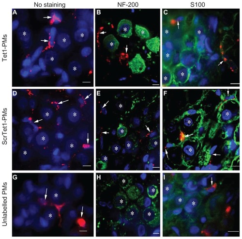 Figure 5 Distribution of Tet1-PMs, ScrTet1-PMs, and unlabelled polymersomes (PMs) in the spiral ganglion architectures after administration via cochleostomy. All three types of PM administrated by cochleostomy were located in the spiral ganglion satellite cells (SGSCs, arrows). PMs were not detected in the neuronal soma of the spiral ganglion cells.Notes: *Nucleus of type I spiral ganglion cells. Red: PMs. Green: NF-200 or S100 immunostaining. Blue: 4,6-diamidino-2-phenylindole. Scale bar = 10 μm.Abbreviations: Tet1-PMs, Tet1-functionalized PMs; ScrTet1-PMs, scrambled Tet1 peptide modified PMs.