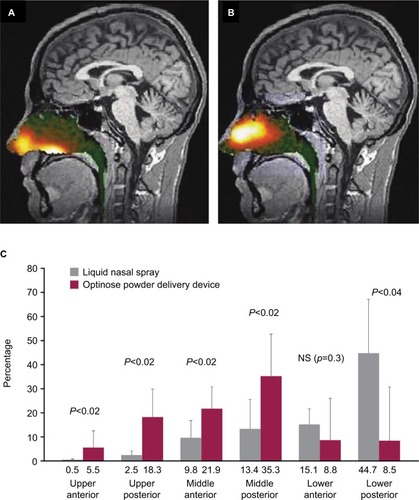 Figure 1 Imaging of intranasal delivery of (A) conventional liquid spray (radiolabeled diethylene triamine pentaacetic acid) vs (B) powder (radiolabeled lactose) with the breath-powered device and (C) quantification of deposition patterns.