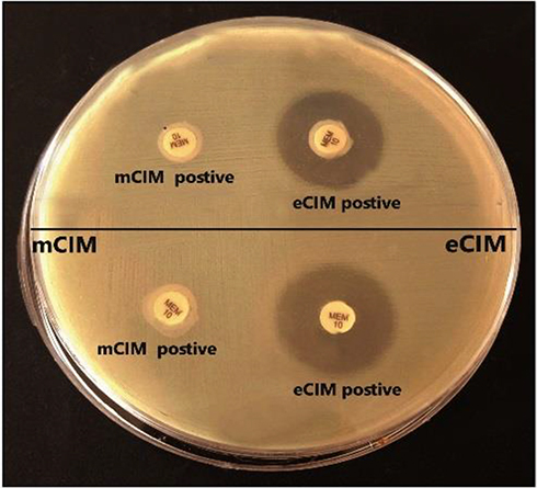 Figure 1 Results of mCIM/eCIM test of 2 CR K. pneumoniae isolates. The two isolates show positive mCIM/eCIM test results indicating MBL production.