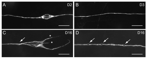 Figure 1. Age-dependent defects of C. elegans touch receptor neurons, revealed by immunostaining of acetylated microtubules. Scale bar, 5 μm. (A) ALM in an animal 2 d of age in adulthood (D2) had a typical spindle-shape soma. (B) The PLM process in a D3 wild type animal. (C) ALM in a D16 animal showed misshapen soma with disorganized microtubule bundles, aberrant neurites (asterisks) and bubble-like lesion of the process (arrow). (D) Multiple bubble-like lesions (arrows) could be found in the PLM process of a D16 animal.