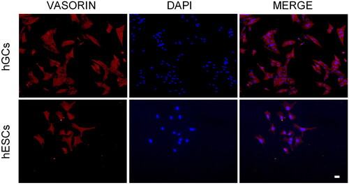 Figure 2. Localization of Vasn in primary cultures of granulosa and endometrial stromal cells by immunofluorescence staining with anti-vasorin (red) and with DAPI (Blue). Scale bar= 20 µm.