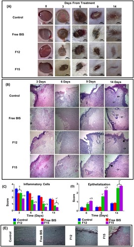 Figure 4 (A) Photographic images of in-vivo excision wound area contortion rate monitoring of control, free BIS, F12 (blank 7% C-ZNFs), and F15 (50% BIS-loaded 7% C-ZNFs scaffolds) vs day of contraction using dorsal of rats(Scale bar is 0.3 cm), (B) Representative images of H&E-stained histologic wound sections of control, free BIS, F12 and F15-treated groups on days 3, 6, 9, and 14 after wounding (The arrow indicates complete epithelisation. BV; blood vessel, GT; granulation tissue, CF; collagen fibers) (C) histologic scoring for inflammatory infiltrate (score from 0–4), (D) epithelisation (score from 0–3) from 9 randomly selected high-power fields (×40) from three H&E-stained cutaneous wound sections and (E) effect of different treatments on collagen fiber formation. (α P < 0.05 vs Control; *P < 0.05 vs Free BIS; β P < 0.05 vs F12 (blank 7% C-ZNFs)).