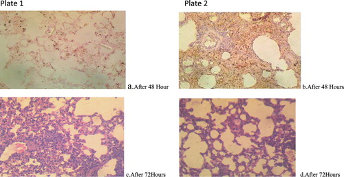 Figure 3. Plate 1(a and c): Aspergillus penicilloides (2.3 × 107): Lung. The airways (alveoli and bronchioles) are clear. There is however moderate haemorrhages and multiple foci of alveolar macrophages laden with dark pigment materials. Plate 2(b and d): Aspergillus penicilloides (3.2 × 105): Lung. There is extensive severe thickening of alveolar interstitium. There is an accumulation of inflammatory cells around blood vessels suggestive of vasculitis. Numerous unstained clear fungal hyphae are trapped in the necrotic debris (Mg: 100×).