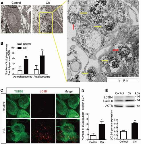 Figure 1. Increased autophagy in cochlear SGNs after cisplatin treatment in vitro. The middle-turn cochleae and SGNs from P3 C57BL/6 WT mice were cultured and incubated with cisplatin for 48 h. (A) TEM analysis evaluated the autophagy in SGNs. Representative images showed that the ER and Golgi apparatus took on a circular structure, which enveloped the targeted cytoplasmic constituents and formed double membrane vesicles, i.e. autophagosomes (red arrows), that eventually fused with lysosomes and formed autolysosomes (yellow arrows) in which the contents are degraded and recycled by lysosome enzymes, n = 4. Scale bars: 2 μm. (B) Statistical analysis demonstrated that there were significantly more autophagosomes and autolysosomes in the SGNs after cisplatin treatment compared with the controls. (C) Immunostaining demonstrated that the LC3B puncta (LC3B-labeling, red) in the damaged SGNs (TUBB3-labeling, green) were significantly increased after cisplatin administration, n = 6. Scale bars: 5 μm. (D) Quantification of the LC3B fluorescent puncta. (E) The protein expression of LC3B-II in SGNs treated with cisplatin was significantly increased compared to the control group, n = 6. All data are presented as the mean ± SEM, * P < 0.05, ** P < 0.01