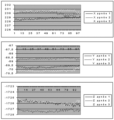 Figure 5. Reproducibility of chest rigid body position over three successive apneas.