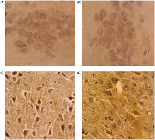 Figure 4. Results of immunohistochemistry for TNF-α expression detection in the hippocampus (CA1-3). A: Group I; B: Group II; C: Group III; D: Group IV. Magnification, 400×.