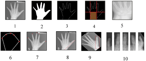 Figure 1. Steps of six ROIs’ extraction from an X-ray image from DHA database.