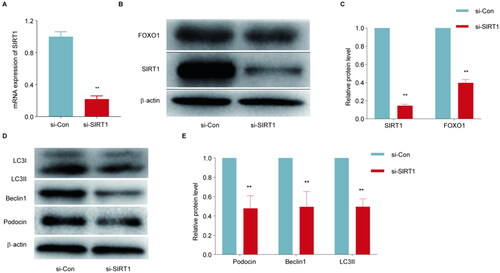Figure 6. Effects of SIRT1 siRNA on SIRT1/FOXO1 and autophagy-related proteins in MPC5 cells treated with high glucose and placenta-derived mesenchymal stem cells (P-MSCs). A: SIRT1 siRNA inhibited P-MSCs from promoting SIRT1 mRNA expression in high glucose-induced MPC5 cells; B-C: Effects of SIRT1 siRNA on SIRT1 and FOXO1 expression in MPC5 cells treated with high glucose and P-MSCs; D-E: Effects of SIRT1 siRNA on podocin and autophagy-related proteins in MPC5 cells treated with high glucose and P-MSCs. (**p < 0.01).