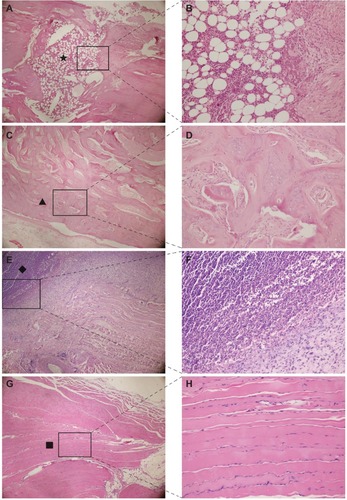 Figure 7 Hematoxylin and eosin staining of bone (A,C) and soft tissue around the implants (E,G). Magnified images in the squared area are displayed (B,D,F,H). Many inflammatory cells (A,B) were observed in the bone marrow cavity in the control group. Many abscesses (E,F) were located in the area around the control implant. New bone formation around the coating (C,D) and basic normal muscle (G,H) were observed in the vancomycin group. (A,C,E,G) (magnification ×40); (B,D,F,H) (magnification ×200). Notes: Black star represents inflammatory cells (A). Black triangle represents new bone formation (C). Black diamond represents abscesses (E). Black square represents basic normal muscle (G).