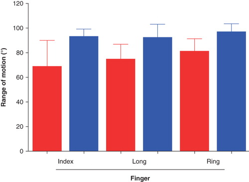 Figure 6. Mean (SD) passive range of motion of the PIP joints preoperatively compared with 6 months postoperatively in the mild group. There was a significant increase in the range of motion for the long finger. Red = before, and blue = after, operation.