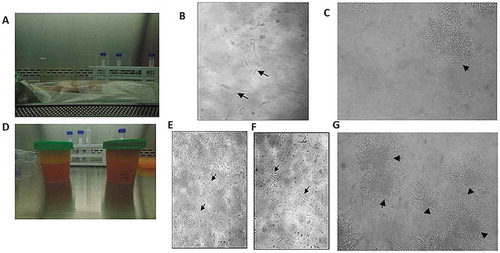 Figure 1. Morphological characteristics of ASCs isolated from RAT and LPA. ASCs isolated from RAT (IA-C) and LPA (II D-G). (I) ASCs isolated from RAT shows (a) unmanipulated RAT delivered post operatively. (b) culture on day 7 where few spindle-like cells started to appear (black arrows). (c) culture on day 28, colonies of fibroblast-like cells were formed (black arrowhead). (II) ADSCs isolated from LPA shows (d) LPA material emptied in sterile cups. (e) Culture on day 0 with numerous rounded non-adherent cells (black arrows). (f) Culture on day 3 shows few single adherent spindle fibroblast-like cells (black arrows). (g) culture on day 28 shows several colonies of fibroblast-like cells (black arrowheads). Images were examined by Olympus IMT-2 inverted light microscopy with 10× and 20× magnification