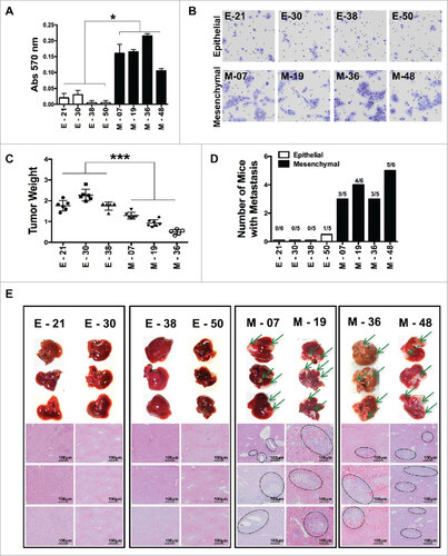 Figure 2. Characterization of epithelial and EMT functional features of individual cloned  sublines derived from K-Ras -pancreatic cells. (A) Matrigel invasion assay of epithelial and EMT cell lines; shown are migrated cells (triplicates +/-SD) Student's t test #P<0.05. (B) Representative pictures of migrated cells in the lower membrane. (C) Tumor weight of different cell lines (5 × 105) cells, grown in NSG mice, two-way ANOVA ##P< 0.01. (D) Incidence of liver metastasis after tumor cell injection (2 × 106) in the spleen. (E) Representative (8 clones; 4 epithelial and 4 mesenchymal) images of liver metastasis (indicated by arrows) and histological sections of liver (H&E staining) to show metastatic nodules in the liver. Scale bar = 100 μm.