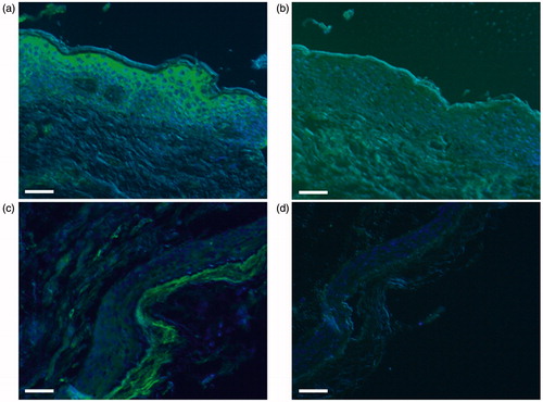 Figure 2. Photomicrographs of fluorescence immunohistochemical staining for TRPV3. The panels show positive staining/negative control pairs of the postauricular skin (a/b) and cholesteatoma tissue (c/d). Green and blue colors express the fluorescence of Alexa Flour 488 and DAPI, respectively. Strong fluorescence in the granular layer and moderate fluorescence in the spinous later are observed in the skin, while fluorescence is moderate in the horny layer and weak in the granular and spinous layers of the cholesteatoma tissue. Scale bar = 50 μm.