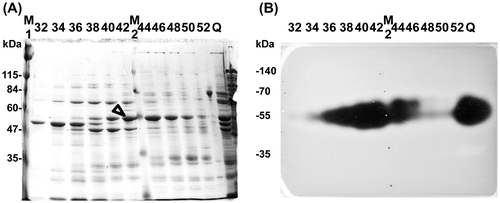 Fig. 1. SDS-PAGE analysis of proteins separated by phenyl Sepharose chromatography.
