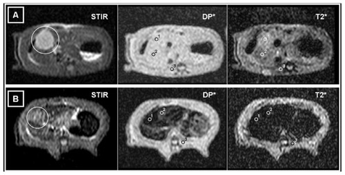 Figure 2 MRIs of two different animals. Axial STIR, DP*, and T2*-weighted sequences at the same slice position. ROIs are located for obtaining measurements of the SI in (1) tumor implants, (2) liver, and (3) paravertebral muscles. (A) MRI of a CG rat. On the STIR image, the liver and the paravertebral muscles are seen to have a similar SI, while the tumor tissue appears hyperintense (white circle). On the DP* image, the neoplastic tissue is not clearly seen. On the T2* image, the tumor appears slightly hyperintense compared to healthy liver tissue. (B) MRI of an IG rat. On the STIR image, the liver and the paravertebral muscles are seen to have a similar SI, while the tumor tissue appears hyperintense (white circle). On the DP* and T2* images, it can be seen that there is a substantial decrease in the SI from healthy liver and, especially, from tumor tissue, due to the presence of magnetic nanoparticles.Abbreviations: MRI, magnetic resonance imaging; ROI, region of interest; SI, signal intensity; CG, control group; IG, infused group.