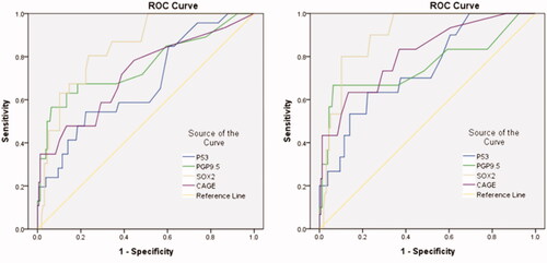 Figure 5. Diagnosis of esophageal cancer patients with Stem signatures associated antibodies. (A) ROC curves of four AAbs distinguishing esophageal cancer group from control groups. (B) ROC curves of four AAbs distinguishing esophageal squamous cell carcinoma cancer group from control groups (benign lesions and healthy people) (B).
