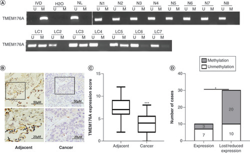Figure 2. Methylation status and TMEM176A staining in primary lung cancer. (A) Representative methylation-specific PCR results. (B) TMEM176A staining in lung cancer and adjacent tissue samples (top: 200×; bottom: 400×). (C) Box plots for TMEM176A expression, horizontal lines represent the median score; the bottom and top of the boxes represent the 25th and 75th percentiles, respectively; vertical bars represent expression levels. (D) Bar diagram: the levels of TMEM176A expression and methylation status.*p < 0.05; ***p < 0.001.IVD: In vitro methylated DNA; LC: Primary lung cancer; M: Methylation; N: Normal lung tissue samples; NL: Normal lymph cell DNA; U: Unmethylation.