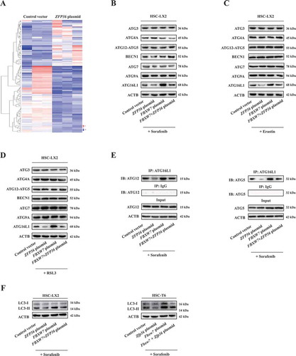 Figure 4. Reduced ferroptosis by ZFP36 plasmid is associated with autophagy inactivation. (A) HSC-LX2 cells overexpressing ZFP36 were treated with sorafenib (10 μM) for 24 h, and total RNAs were extracted for RNA-Seq. Microarray heat map demonstrates clustering of HSC-LX2 cells. Hierarchical cluster analyses of significantly differentially expressed mRNAs: bright blue, underexpression; gray, no change; bright red, overexpression (Control vector, n = 3; ZFP36 plasmid, n = 3). (B-D) HSC-LX2 cells overexpressing ZFP36 and FBXW7 were treated with erastin (10 μM), sorafenib (10 μM), and RSL3 (2.5 μM) for 24 h. The protein levels of ATG3, ATG4A, ATG12–ATG5, BECN1, ATG7, ATG9A, and ATG16L1 were determined (n = 3 in every group). (E) HSC-LX2 cells overexpressing ZFP36 and FBXW7 were treated with sorafenib (10 μM) for 24 h. The protein complex of ATG12–ATG5-ATG16L1 was assayed by immunocoprecipitation (n = 3 in every group). (F) HSC-LX2 and HSC-T6 cells overexpressing ZFP36 and FBXW7 were treated with sorafenib (10 μM) for 24 h. The protein levels of LC3-I/II were determined (n = 3 in every group).