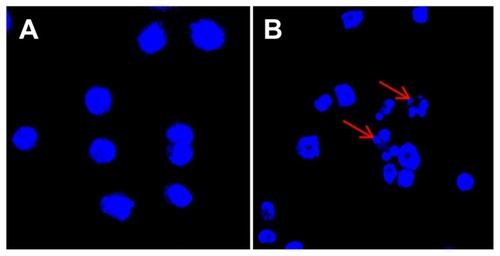 Figure 3 CNPs induce apoptosis in SO-Rb 50 cells. Fluorescence micrographs of SO-Rb 50 cells are shown after exposure to (A) blank micelles and (B) CNPs at 54.4 μg/mL for 24 hours (400× magnification).Notes: Cells were stained with Hoechst 33342 to visualize nuclear morphology. Blank micelle-treated SO-Rb 50 cells have round nuclei with homogeneous chromatin. The cells treated with CNPs are characterized by chromatin condensation, a reduction of nuclear size, and nuclear fragmentation (red arrows show nuclear fragmentation).Abbreviation: CNPs, celastrol nanoparticles.