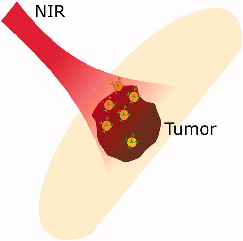 Figure 4. Photothermal therapy: near infra-red radiation is absorbed by tumour with embedded gold nanoparticles.