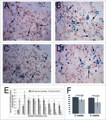 Figure 5. Cell intramuscular implantation and engraftment in mdx mice. With immunohistochemical staining for dystrophin in the cell implanted skeletal muscle of mdx mice, we detected the dystrophin positive myofibers in both of MMP1 genetically engineered C2C12 myoblasts (C and D) and control C2C12 myoblasts (A and B) at 2 weeks (A and C) and 4 weeks (B and D) after intramuscular injections. With measuring the dystrophin positive myofibers, we found the genetically engineered myoblasts formed larger and greater in numbers compared to control C2C12 myoblasts (E and F). (The average is illustrated with standard errors: *P < .05, or **P < .01).