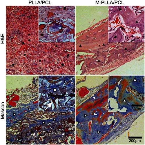 Figure 6 Histological analysis for in vivo calvaria defect repair. The magnification of figures and inlets is uniform.Abbreviations: PLLA, poly(l-lactic acid); PCL, poly(ε-caprolactone)；M-PLLA/PCL，hydroxyapatite-coated hierarchical PLLA/PCL nanofibrous scaffold.